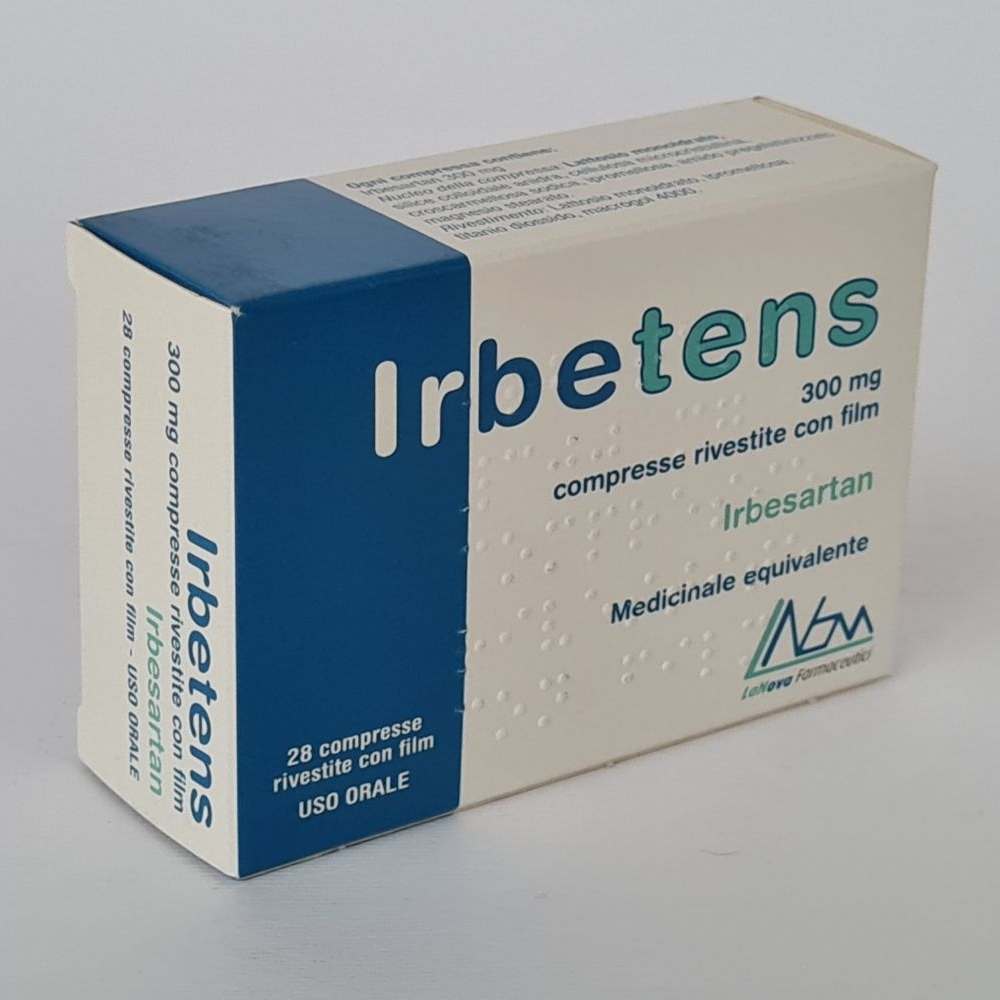 Irbetens